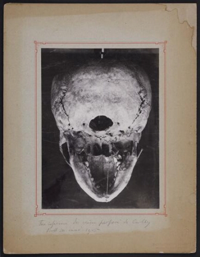 Face inférieure du crâne perforé de Cully